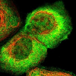 ARHGEF5 Antibody, Novus Biologicals:Antibodies:Primary Antibodies